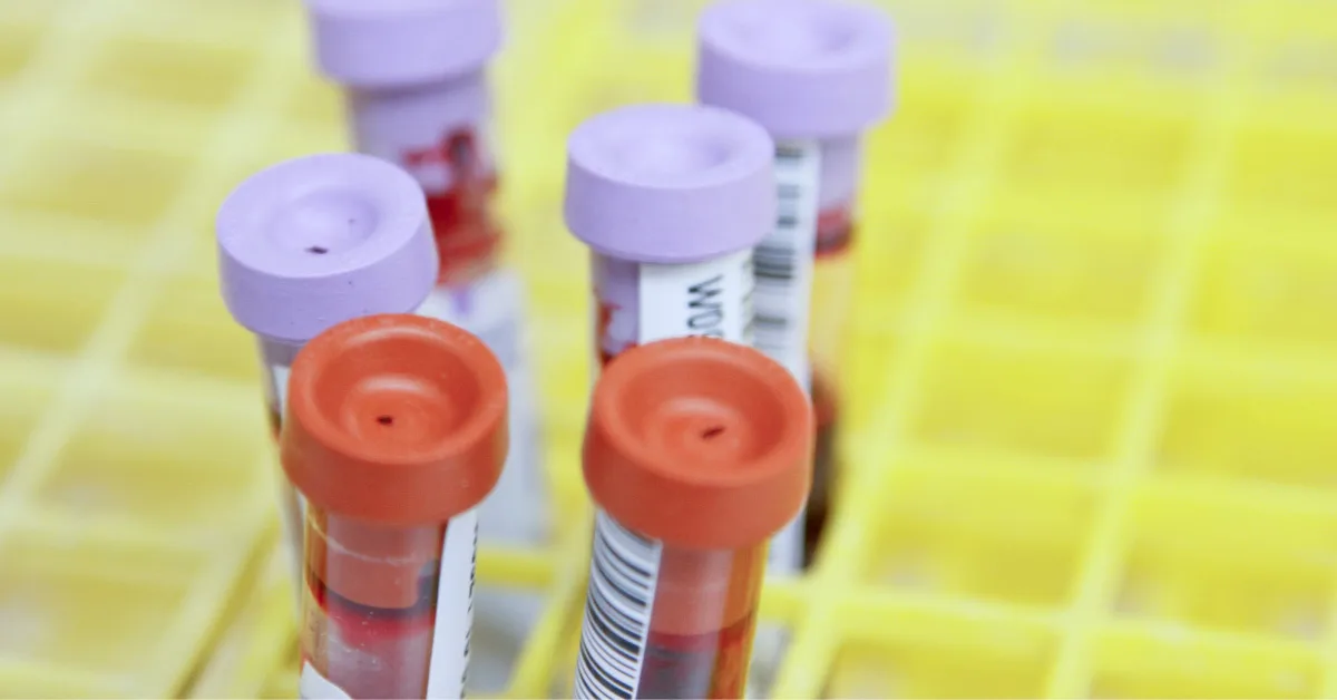 Blood vials with purple and orange caps.